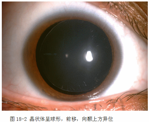 ZY016_90_3.gif
